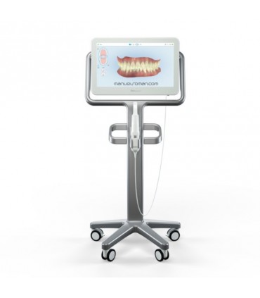 ITERO ELEMENT 2 INTRAORAL SCANNER