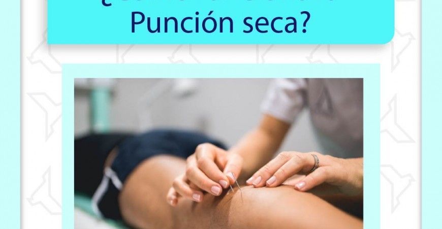 ¿Cómo funciona la punción seca?