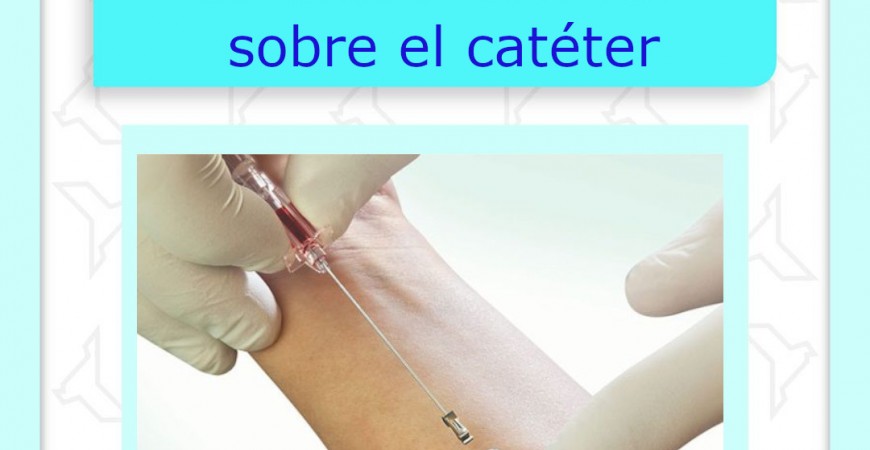 10 curiosidades sobre el catéter